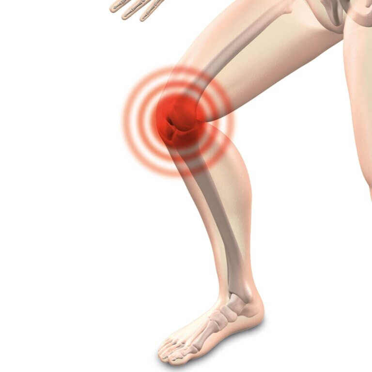 douleur au genou due a l'arthrose
